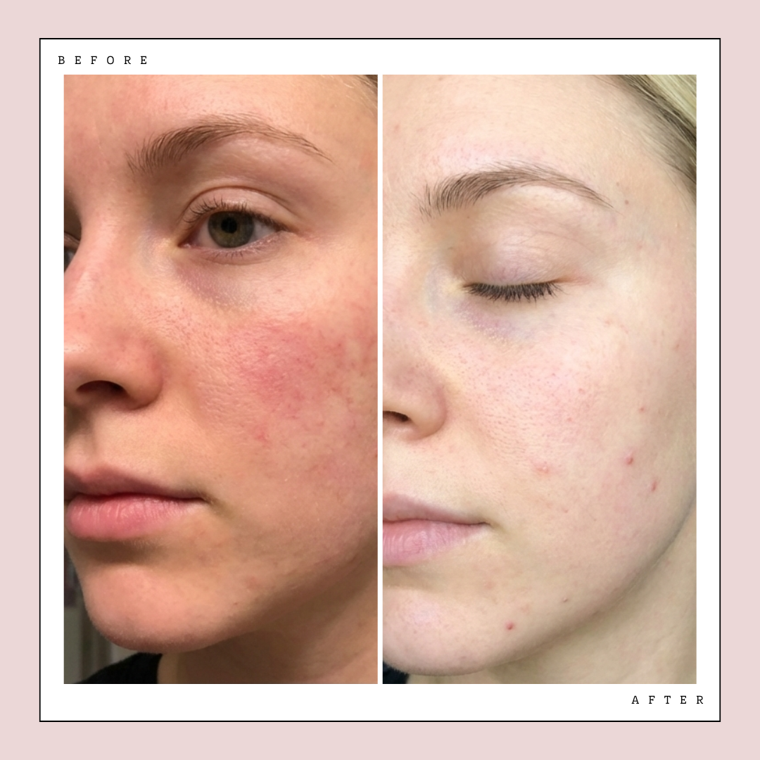 Glow LED Mask Pro | LED Face Mask Glow Theory Glow LED Mask Pro | LED Face Mask