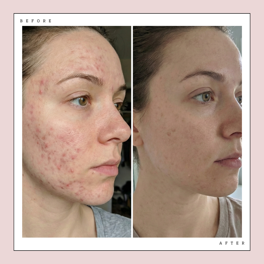 Glow LED Mask Pro | LED Face Mask Glow Theory Glow LED Mask Pro | LED Face Mask