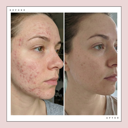 Glow LED Mask Pro | LED Face Mask Glow Theory Glow LED Mask Pro | LED Face Mask